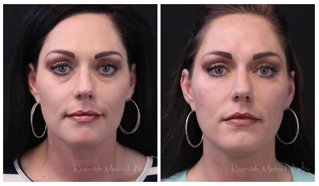 Screen-Shot-2022-11-05-at-2.44.46-PM