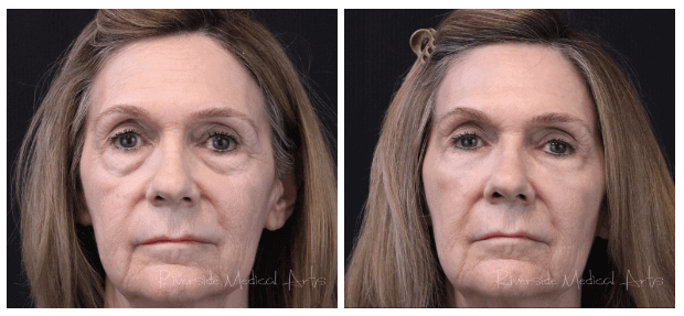 Screen-Shot-2022-11-05-at-2.45.23-PM