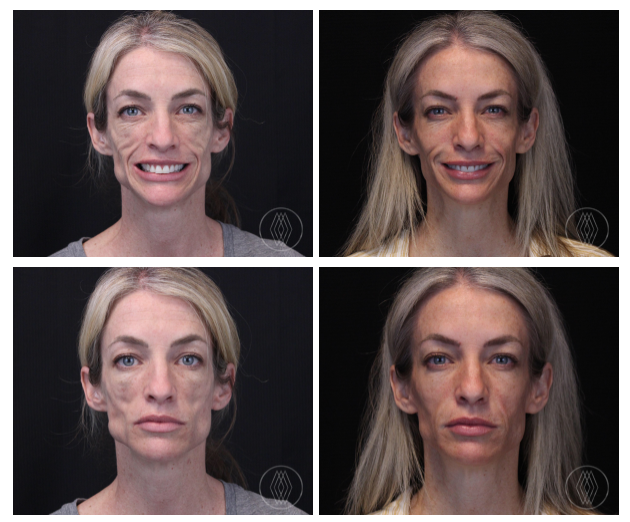 Screen-Shot-2022-11-05-at-3.06.34-PM