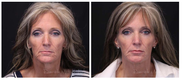 Screen-Shot-2022-11-05-at-3.06.48-PM